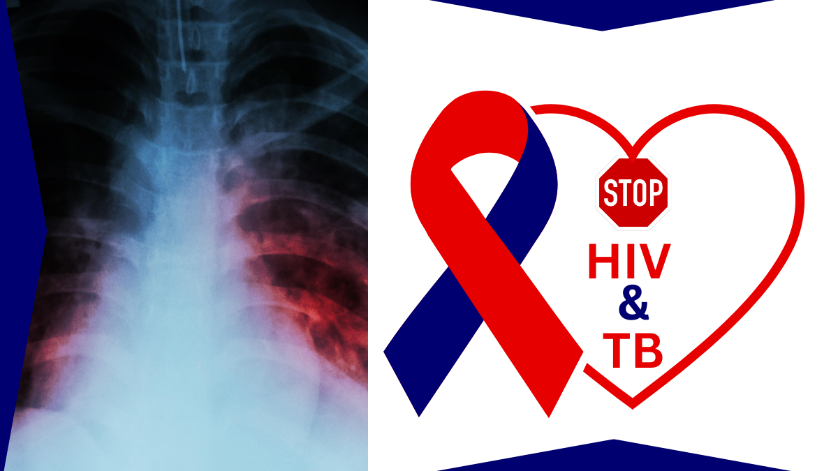TB/HIV: COLLABORATION YIELDS INCREASED IDENTIFICATION, TREATMENT OF CLIENTS